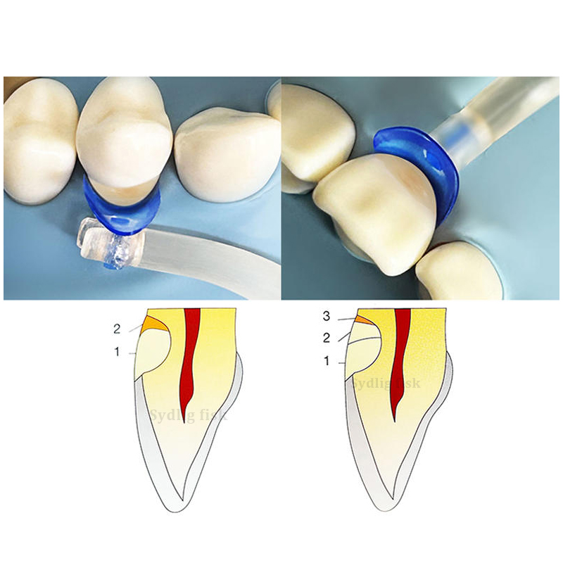 102 adet/takım diş matrisi mav - Resin Art Tool Kit incelemesi ve fiyatı